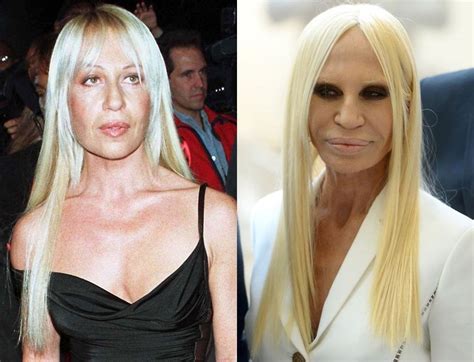 donatella versace before and after plastic surgery|donatella versace without make up.